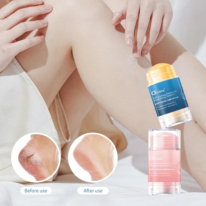 Creme anti-rachaduras para pés - Heels avaliação e preço